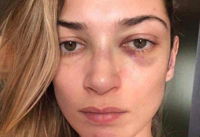 Caso-Luciana-Sinzimbra-1