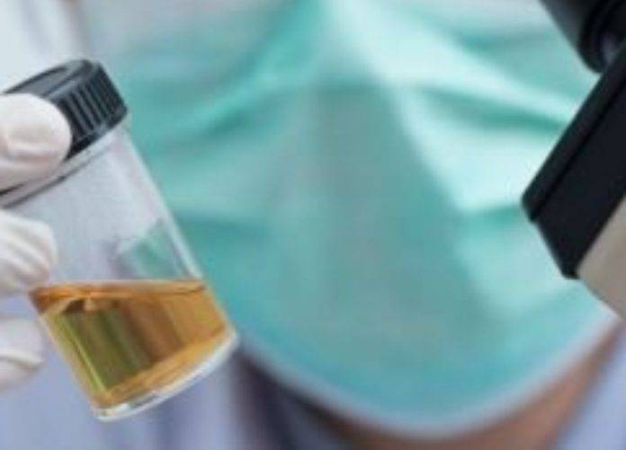 minha20vida20-20exame20de20urina20papanicolau34782242427