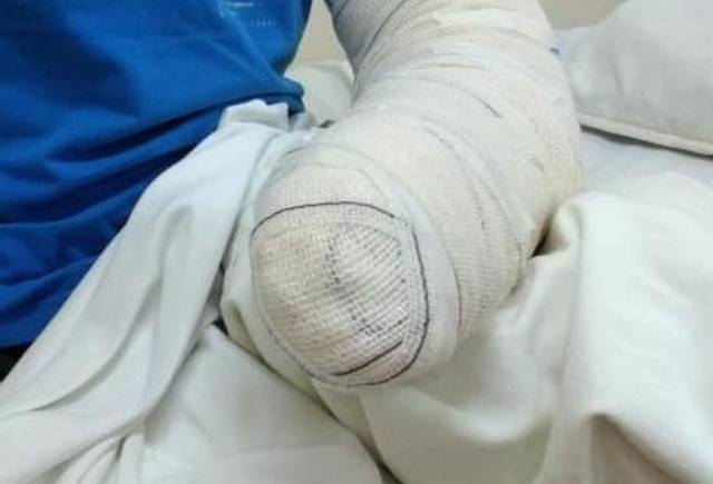 idoso-picado-aranha-g1