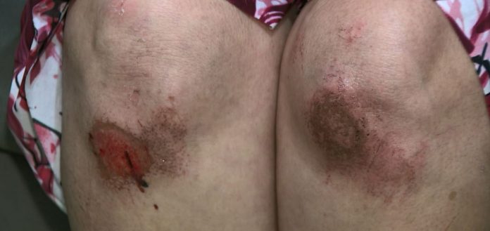 agride-uber-campinas