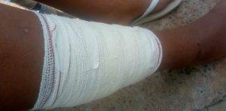 Adolescente de 13 anos baleado na Chácaras Granja São Francisco estava jogando bola