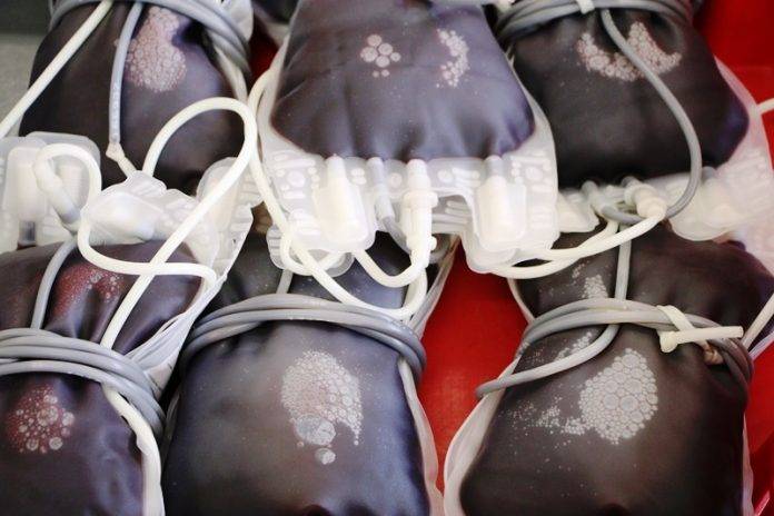 20210208165924_Sangue_080221