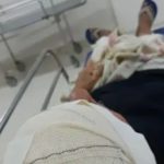 Casal de idosos é espancado por criminosos dentro de casa em condomínio de Campinas, SP